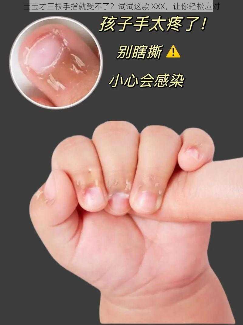 宝宝才三根手指就受不了?试试这款 XXX,让你轻松应对