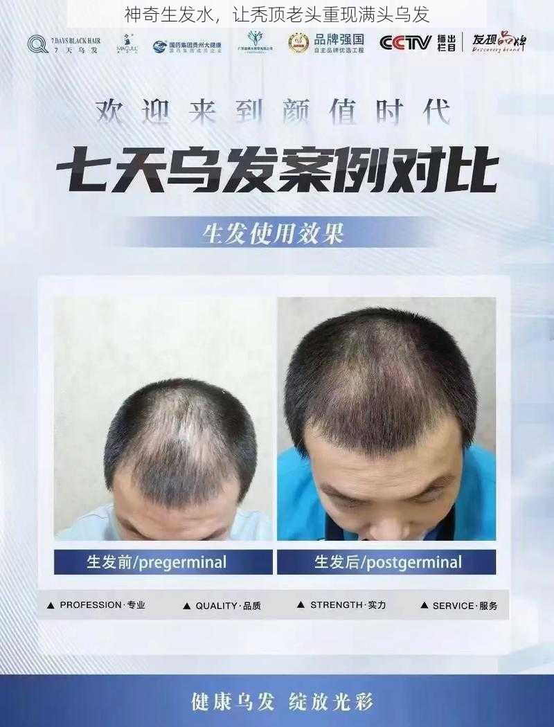 神奇生发水,让秃顶老头重现满头乌发