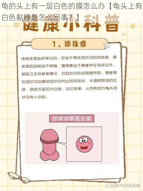 龟的头上有一层白色的膜怎么办【龟头上有白色黏膜是怎么回事?】
