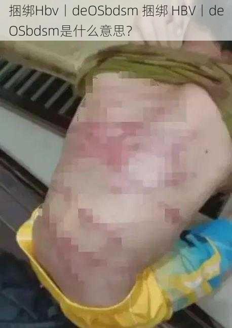 捆绑Hbv丨deOSbdsm 捆绑 HBV丨deOSbdsm是什么意思?
